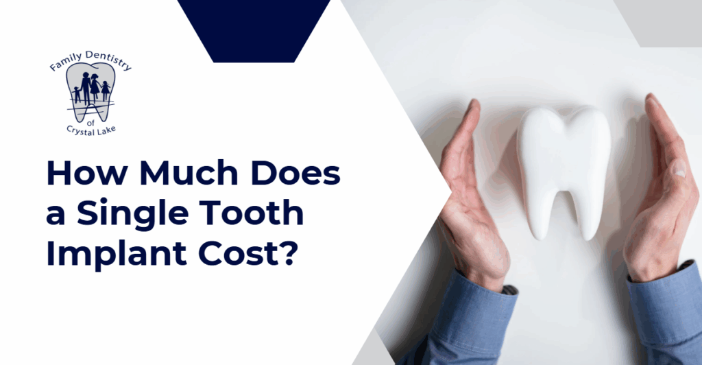 A visual breakdown of the cost of single tooth implants, featuring a large model tooth protected by open hands.