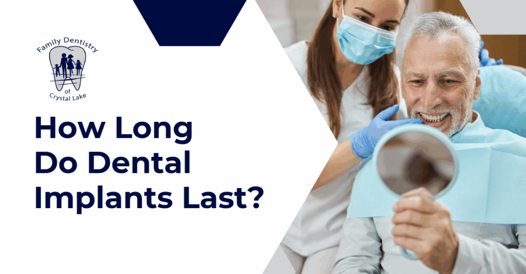 (Smiling older man looking at his teeth in a mirror while a dental professional stands beside him, with text asking how long dental implants last.)