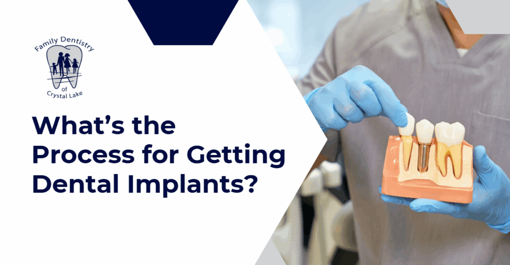 (Dental professional in gloves holding a tooth model and pointing to a dental implant, with text asking about the process for getting dental implants.)