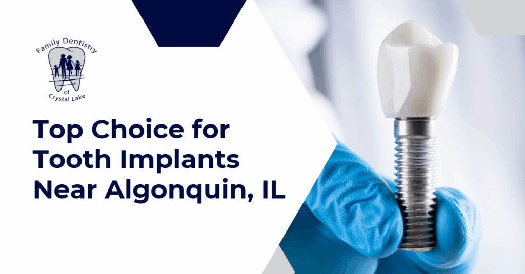 A dental professional holds a tooth implant with gloved fingers, highlighting top implant care near Algonquin, IL
